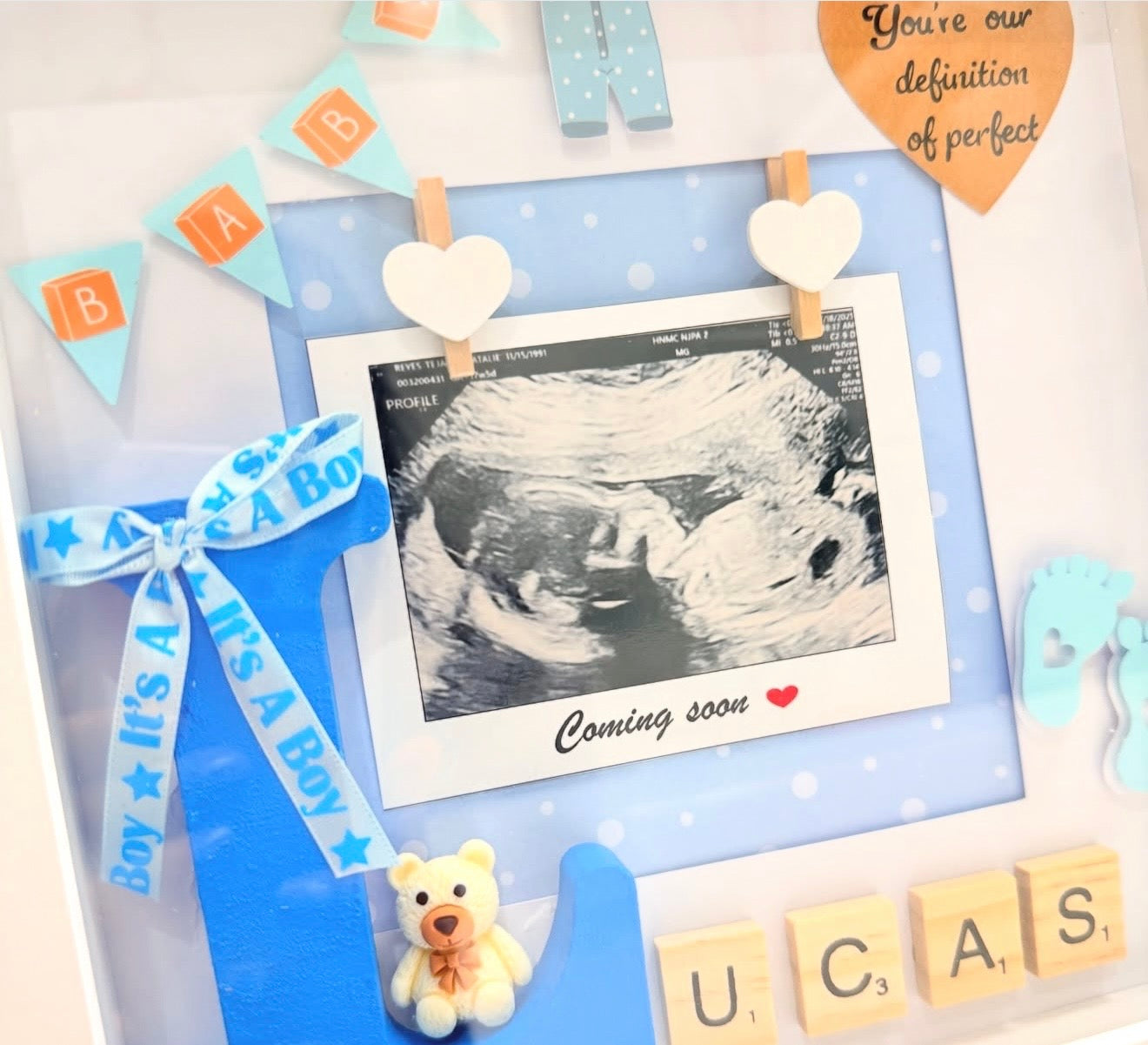 Baby Ultrasound Keepsake Frame(Photo Included)